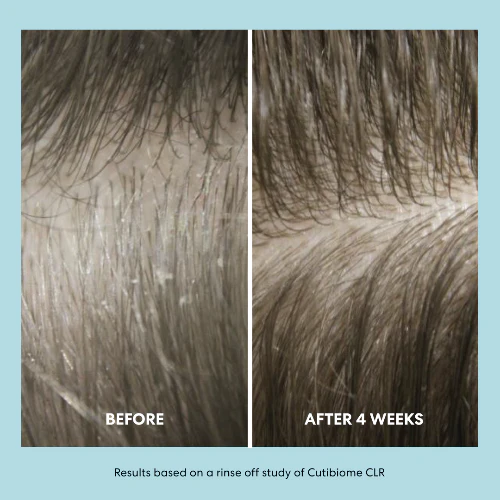 The Shampoo and Conditioner Bundle - Image 5