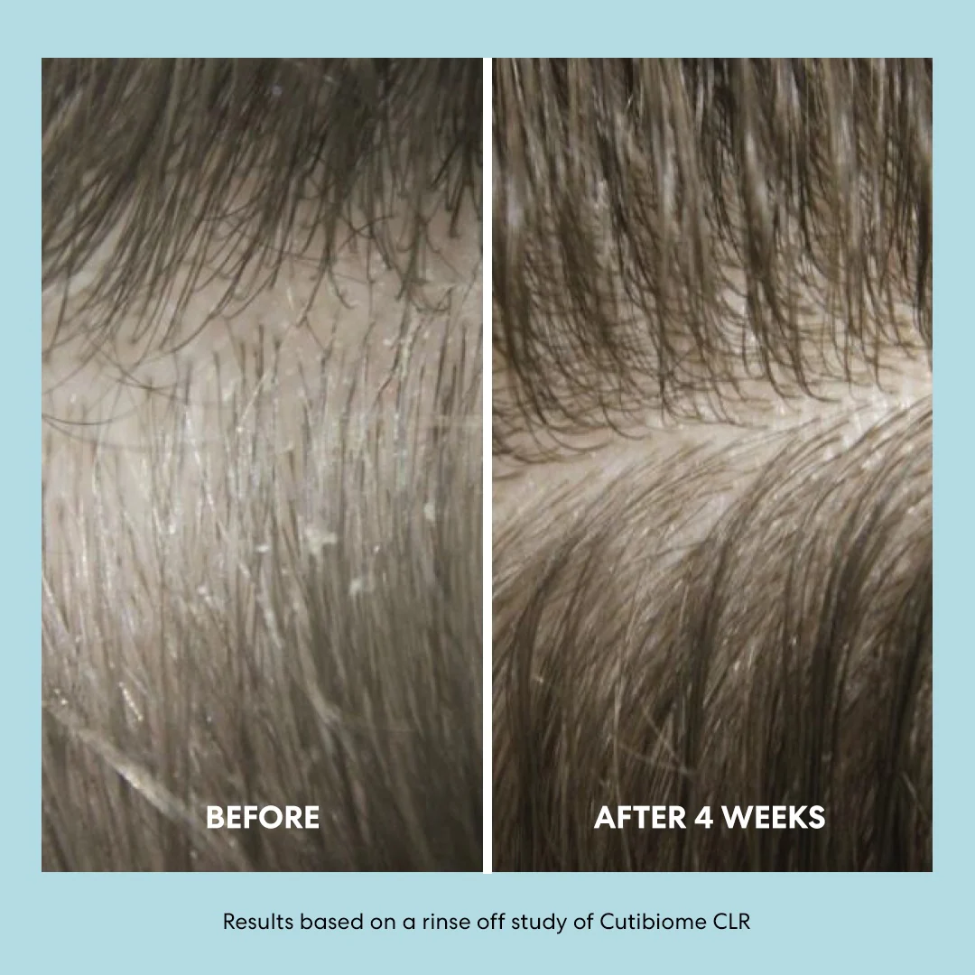 The Shampoo - Image 4